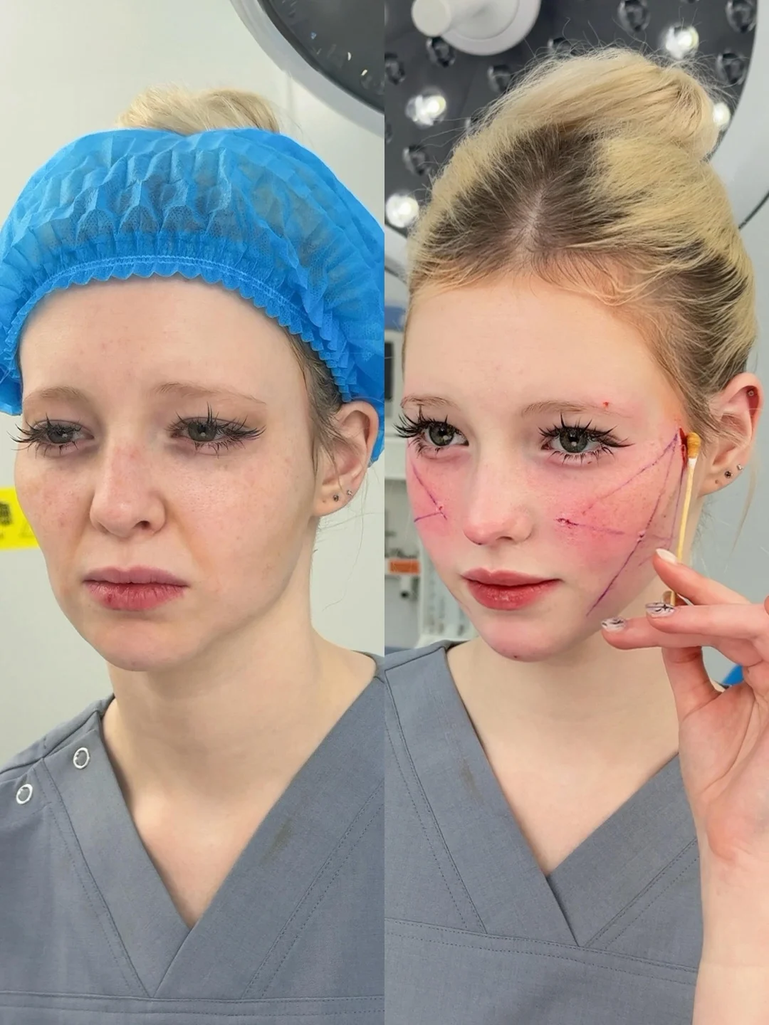 Обучение 9D Face Lifting в Китае